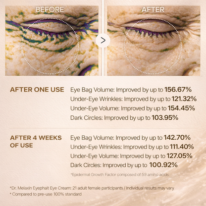 Exilir - Dr.Melaxin Eyephalt Eyebag Cream